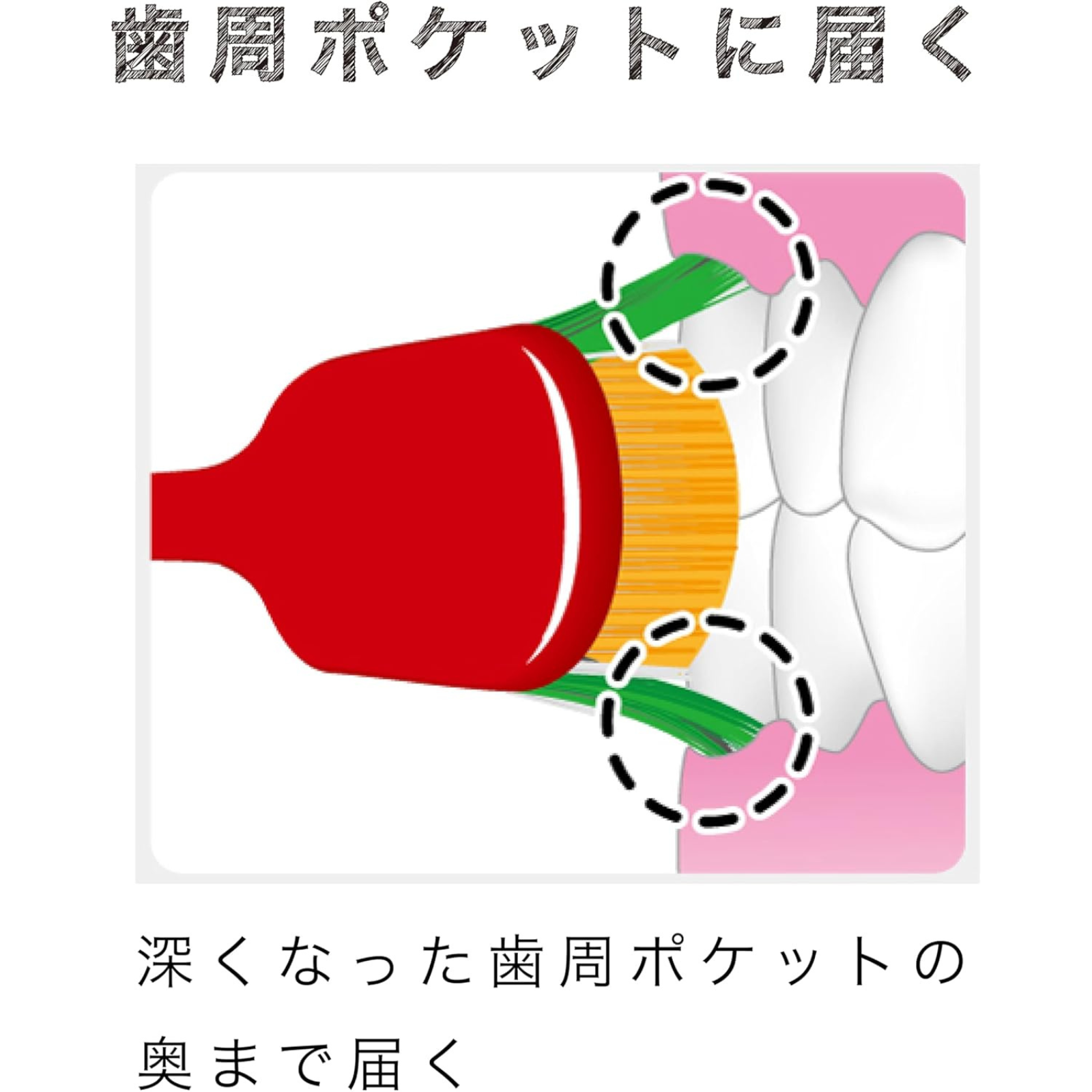 Illustration of EBiSU THE PREMIUM CARE SELECT toothbrush showing ultra-fine bristles reaching deep into gum pockets for gentle and effective cleaning, Made in Japan and available in the UK